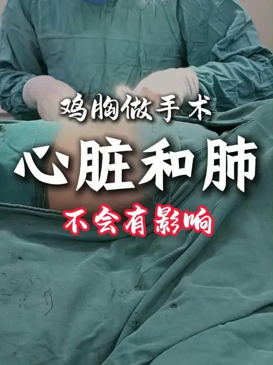 鸡胸做矫正手术会不会对心肺有影响?不会有影响,我们做手术是把心肺沉降到正常位置,让心脏和肺
