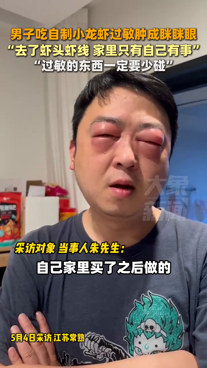 男子吃自制小龙虾过敏肿成眯眯眼