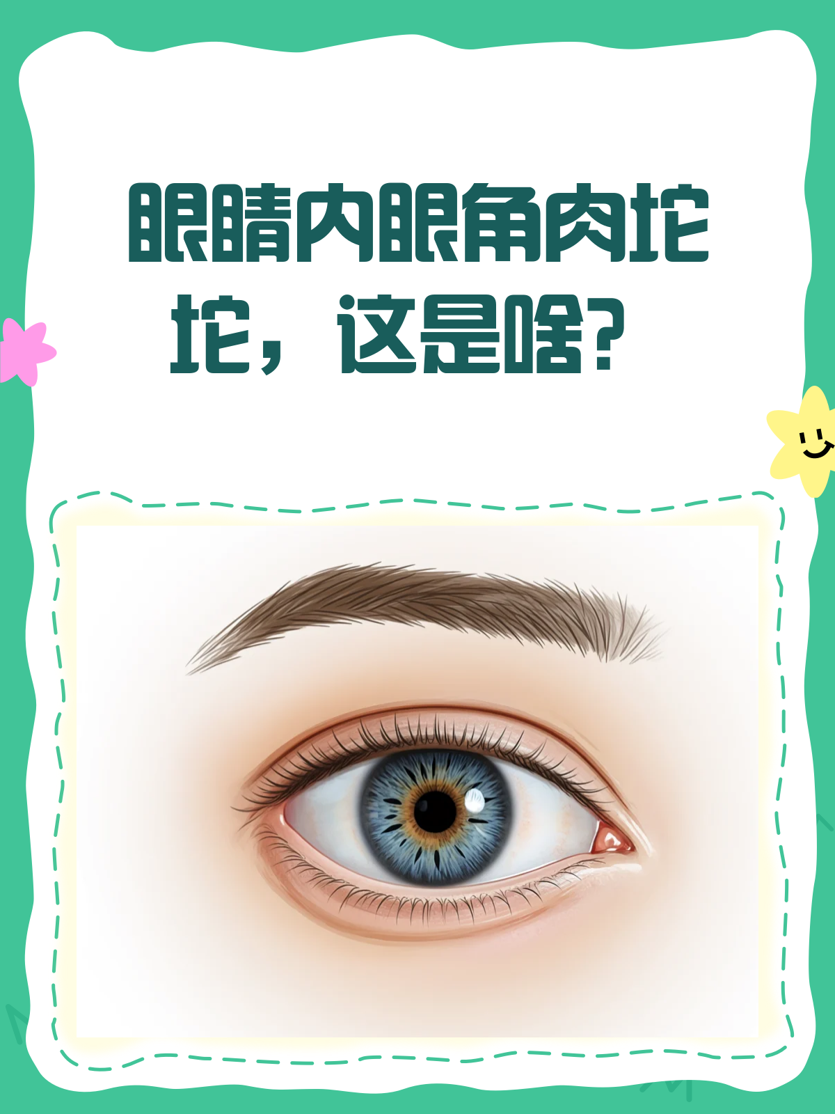 眼睛内眼角肉坨坨,是病还是正常?
