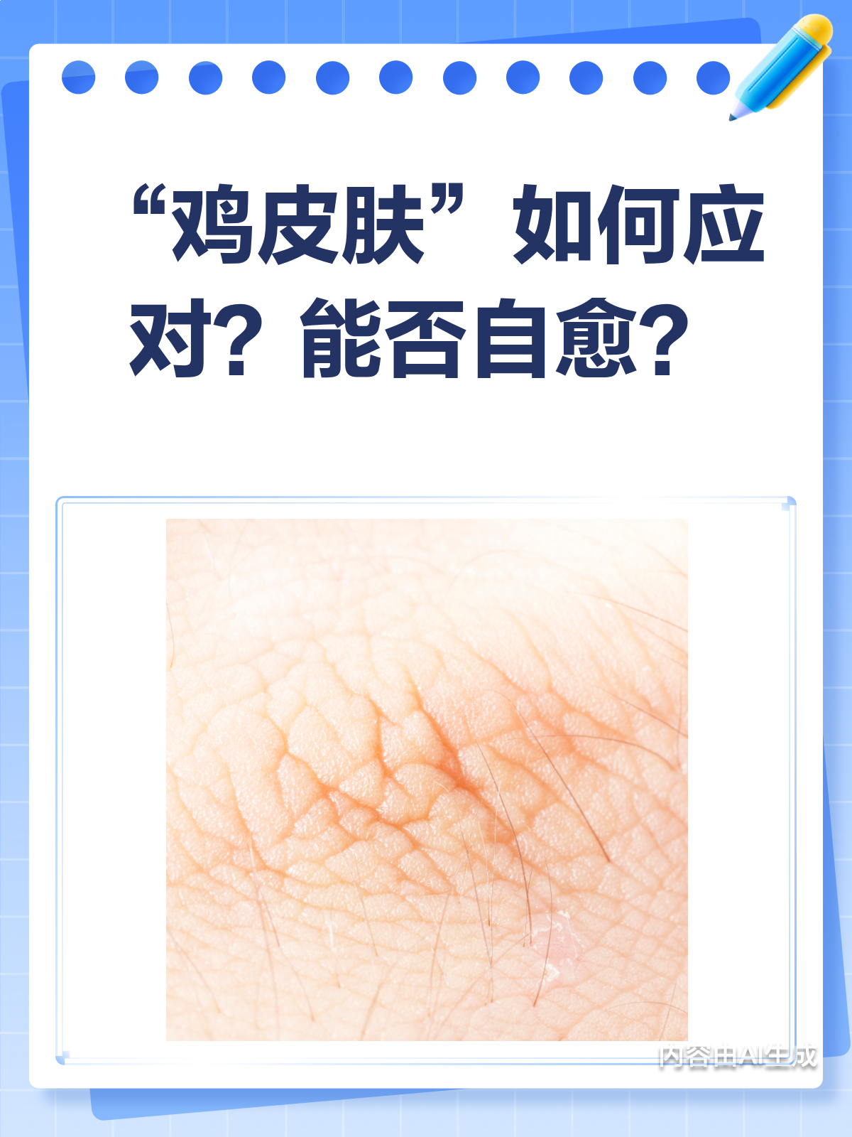 “鸡皮肤”能自愈吗?季节性变化大揭秘!