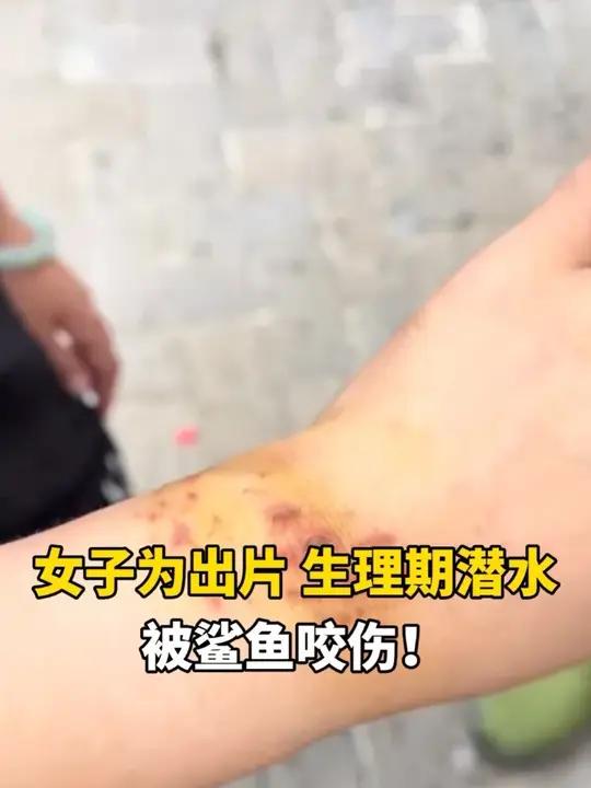 女子为出片,生理期潜水,被鲨鱼咬伤!