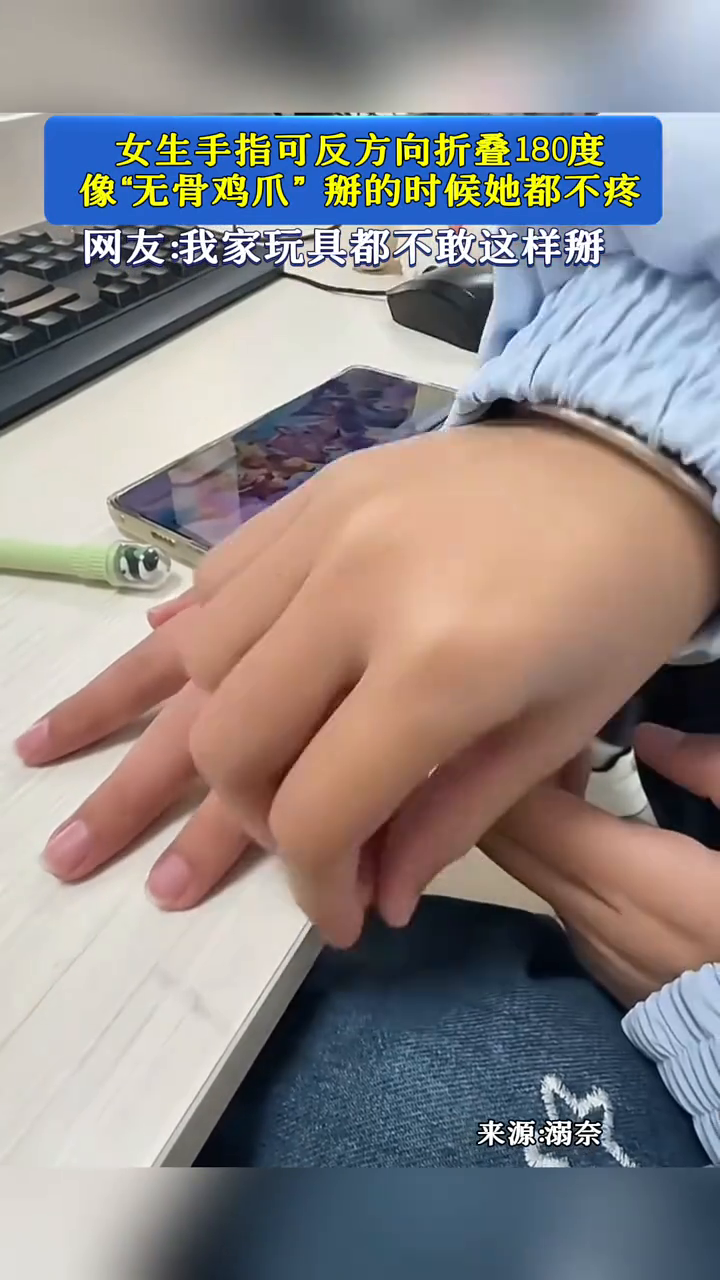 女生手指可反方向折叠180度!像“无骨鸡爪”掰的时候她都不疼