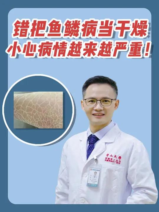 错把鱼鳞病当干燥,小心病情越来越严重!
