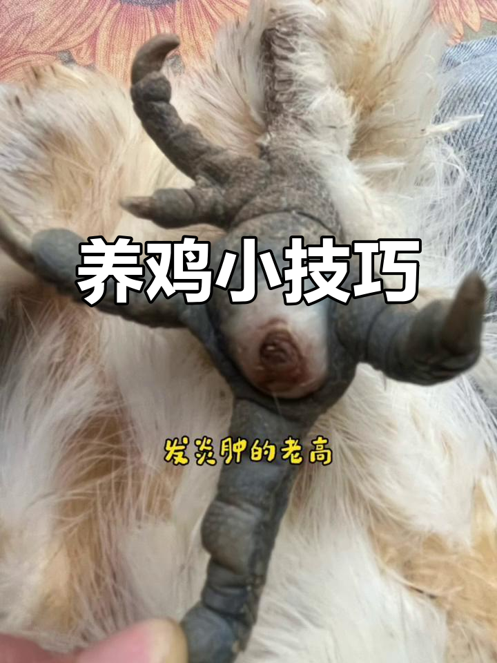 鸡眼发炎怎么办?简单治疗法教你轻松搞定