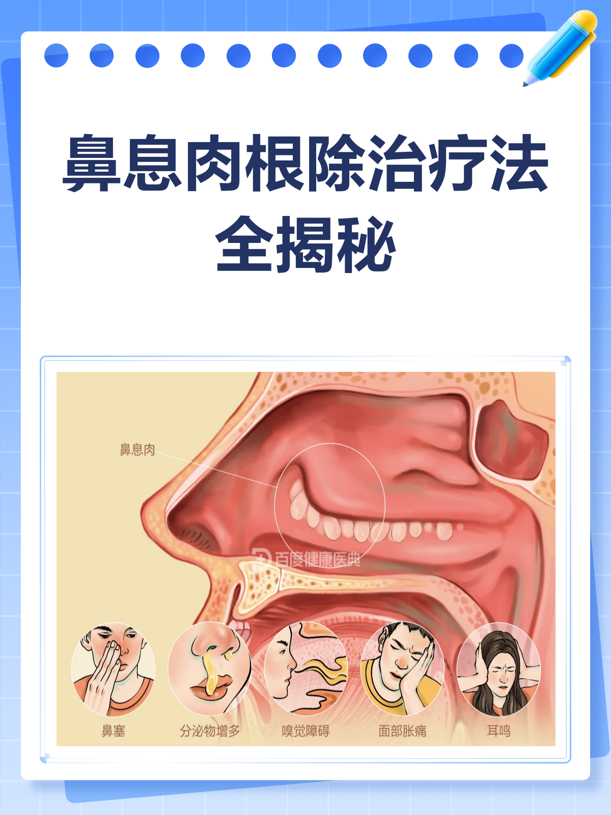 鼻息肉烦恼?来看这份根除治疗指南!