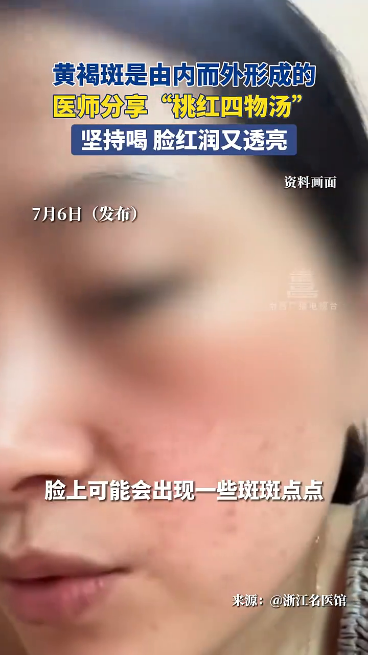 黄褐斑是由内而外形成的,医师分享“桃红四物汤”