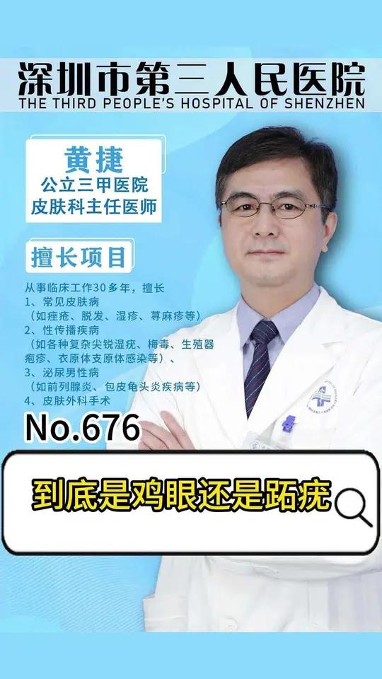 到底是鸡眼还是跖疣 听黄捷医生分析鸡眼与跖疣的区别