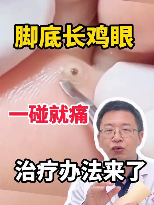 脚底长鸡眼 一碰就痛 治疗方法来了