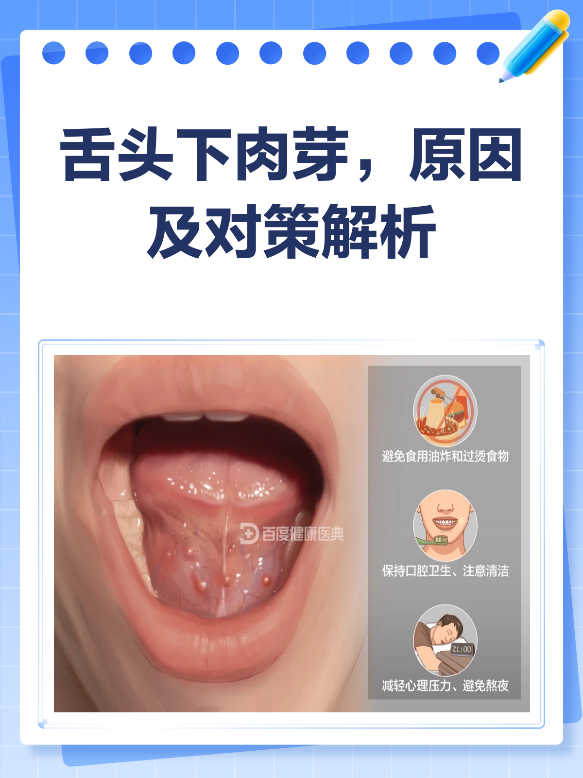舌头下长小肉芽是病吗？一文给你讲明白！