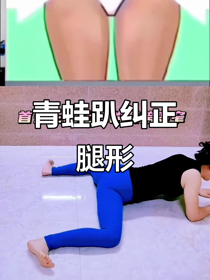 青蛙趴能矫正腿型，解决假胯、XO型腿和膝盖问题