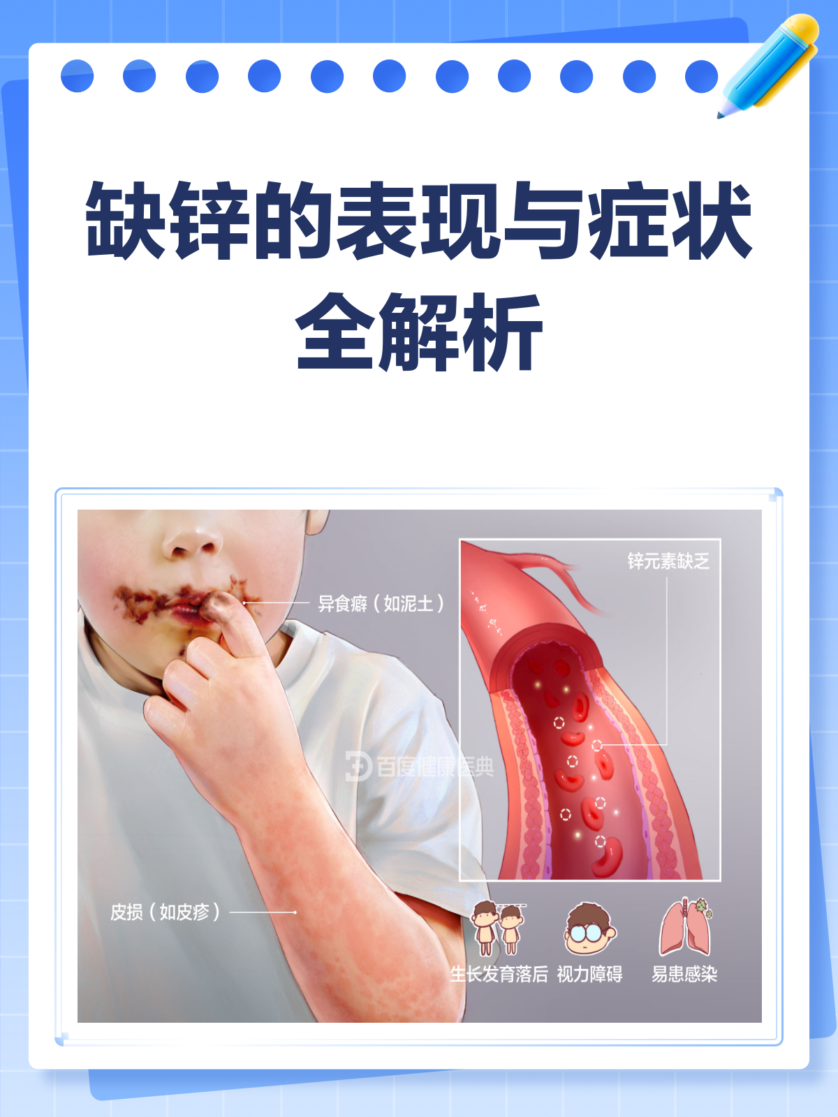 缺锌的表现和症状，你了解多少？