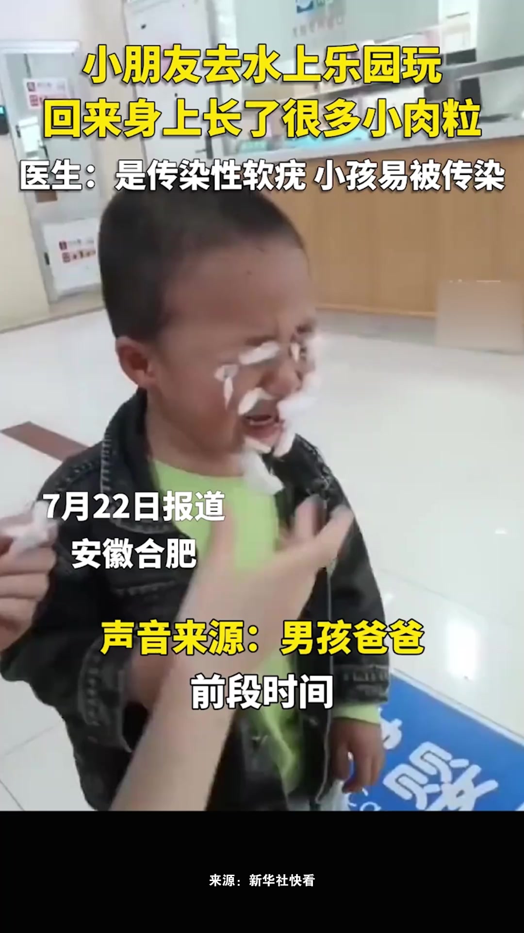 小朋友去水上乐园玩,结果回来身上长了很多小肉粒,医生:是传染性软疣,小孩易被传染