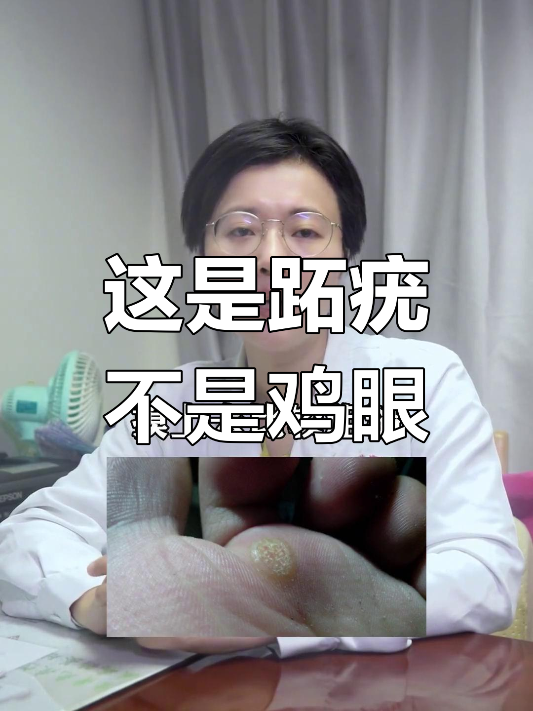 这不是鸡眼,是跖疣!不及时治疗会越来越多