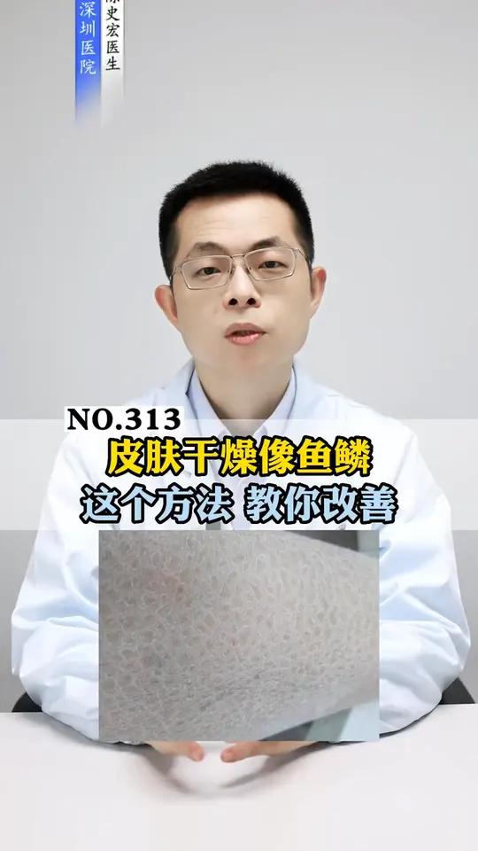 腿上皮肤干燥粗糙,像鱼鳞一样,教你一个方法改善