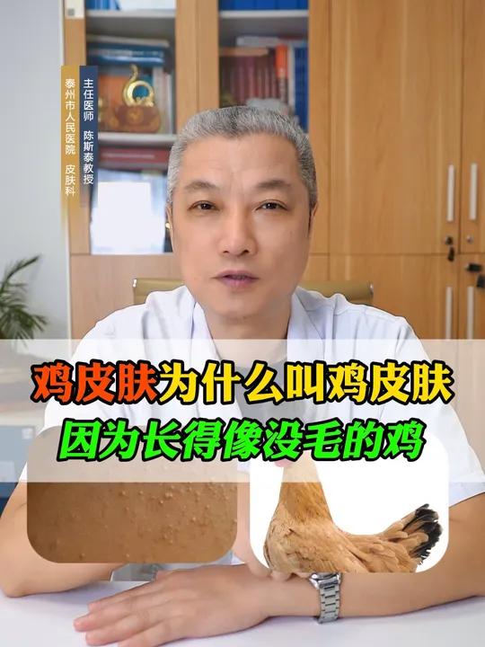 为什么叫鸡皮肤?有什么改善方法