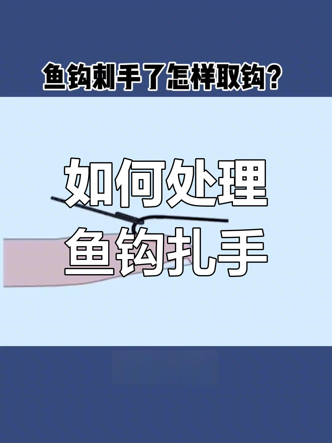 鱼钩刺手怎么办?教你快速拔出技巧