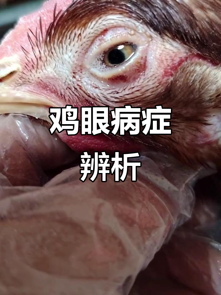 鸡眼症状多样,需区分病因治疗