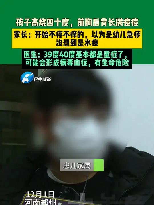 12月1日河南郑州。孩子高烧四十度,前胸后背长满痘痘。家长:开始不疼不痒的,以为是幼儿急疹