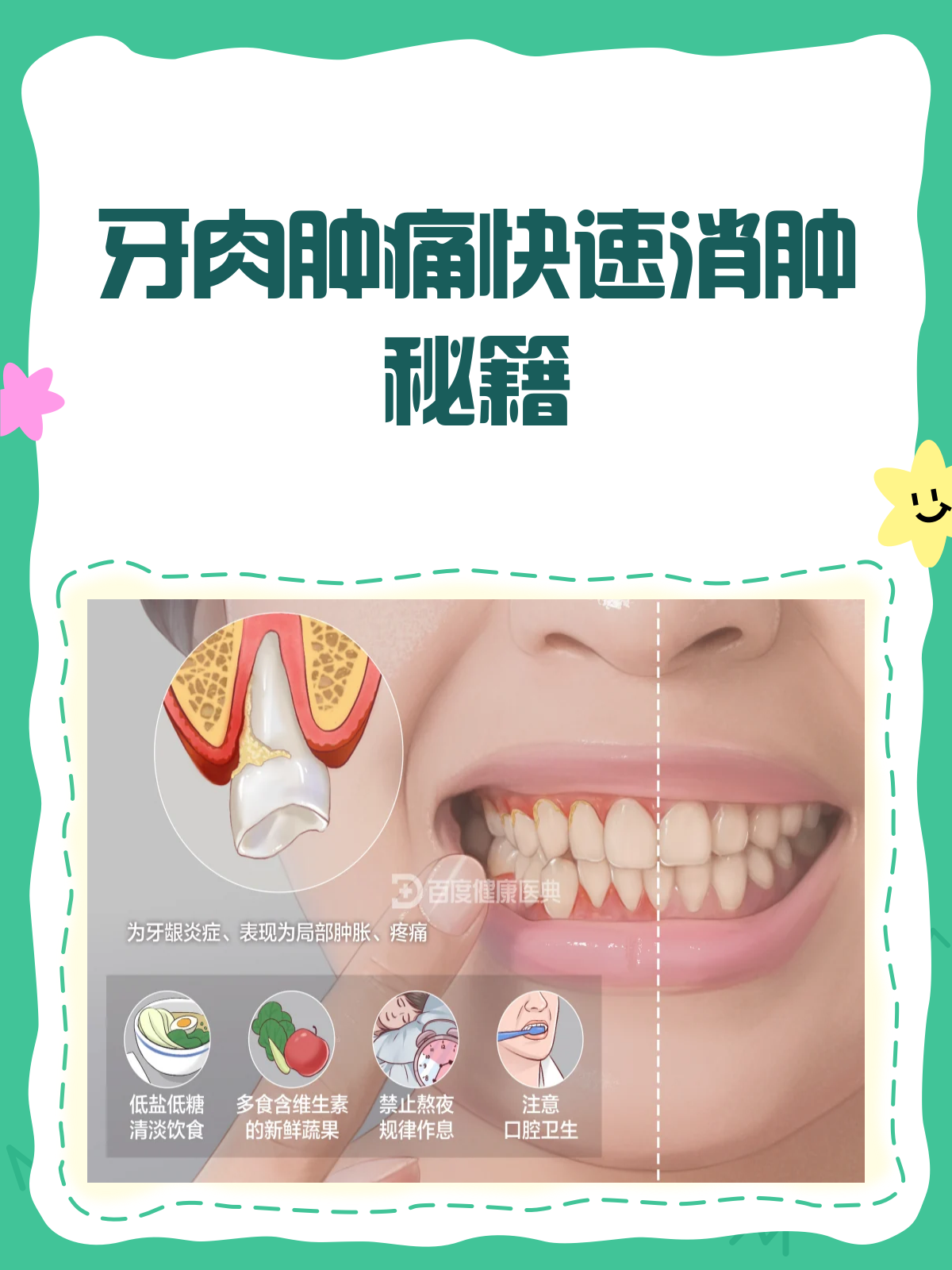 牙肉肿痛别烦恼,快速消肿有妙招