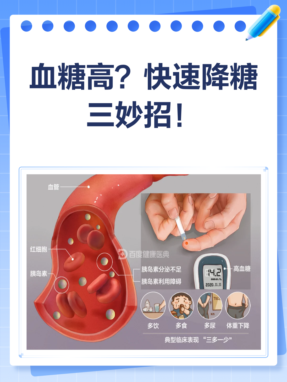 血糖高了怎么办?快速降糖小妙招来啦!