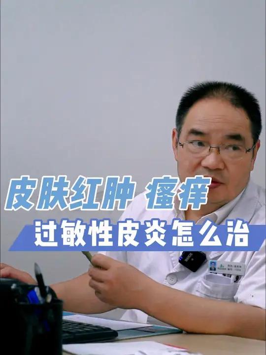 皮肤红肿瘙痒,过敏性皮炎怎么治
