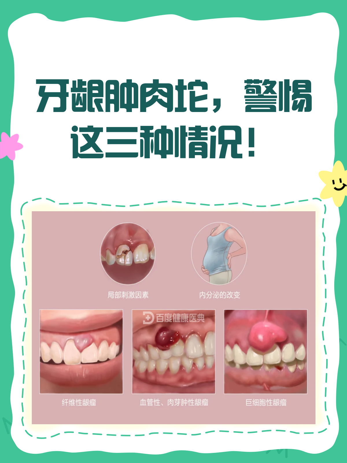 牙龈肿肉坨,别不当回事!