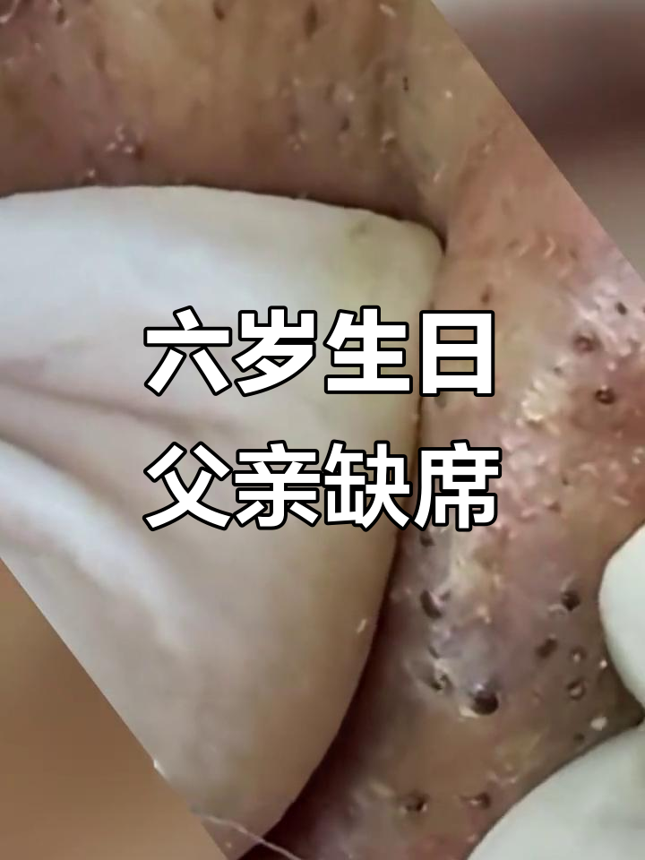 儿子六岁生日,爸爸送蛋糕却因花生过敏险些丧命