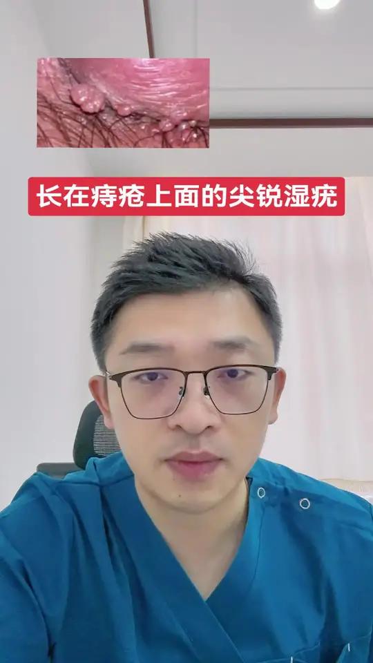 长在痔疮上面的尖锐湿疣