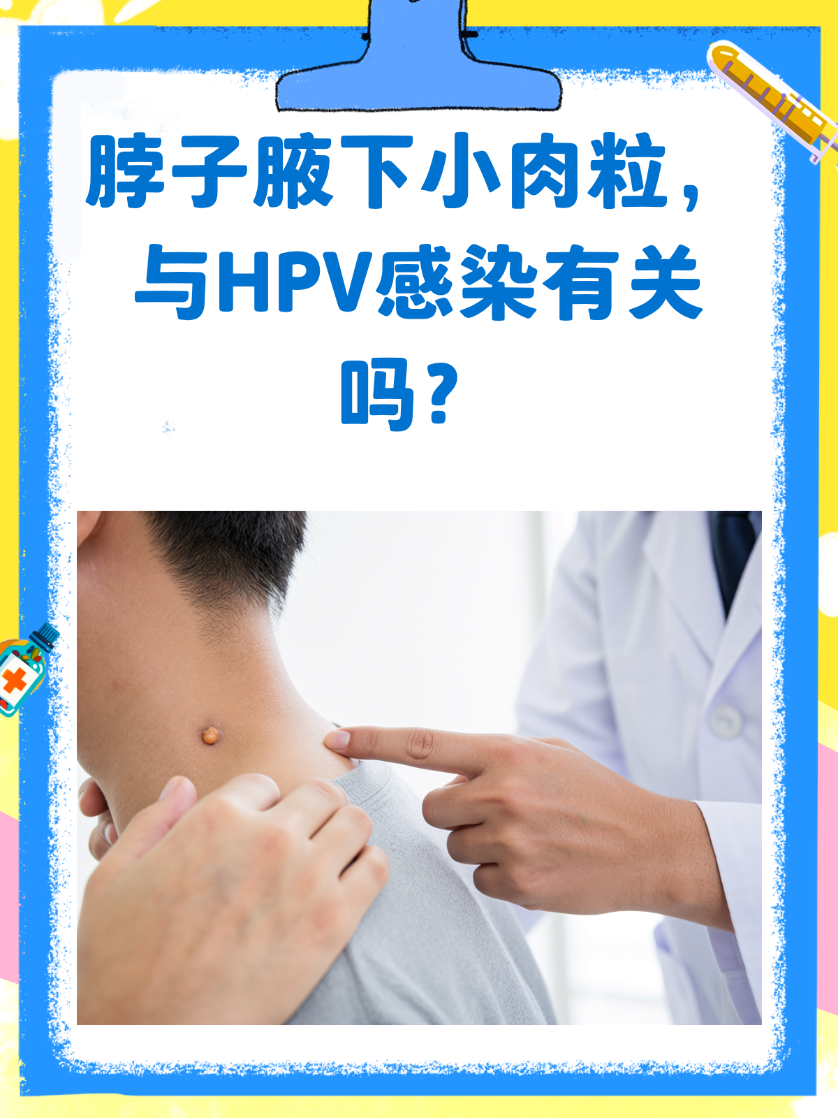 脖子和腋下的小肉粒,是HPV感染吗?