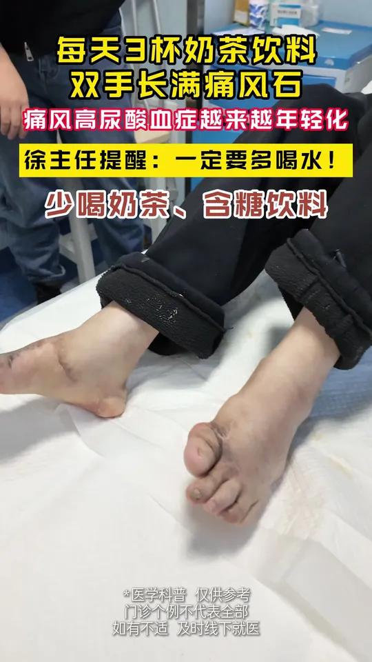一天三杯奶茶到底有多厉害