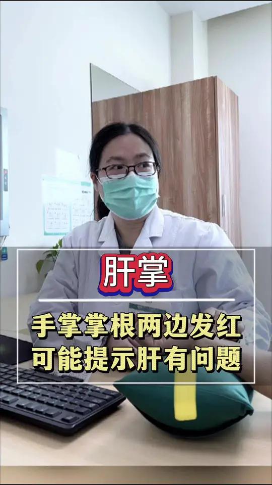 双手手掌掌跟部位两侧的大、小鱼际及各手指内侧面呈粉红色斑块,表现为朱砂色,小心是肝掌