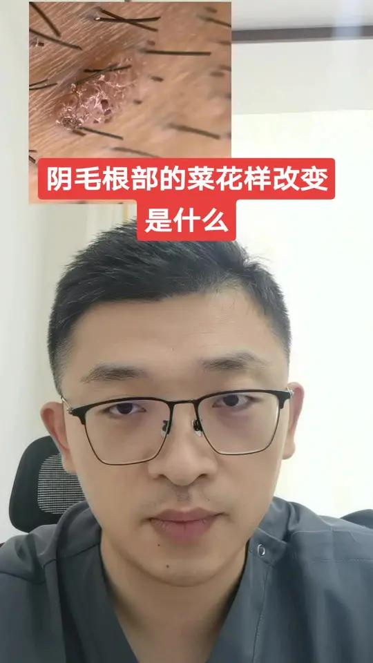 阴毛根部的菜花样改变是什么