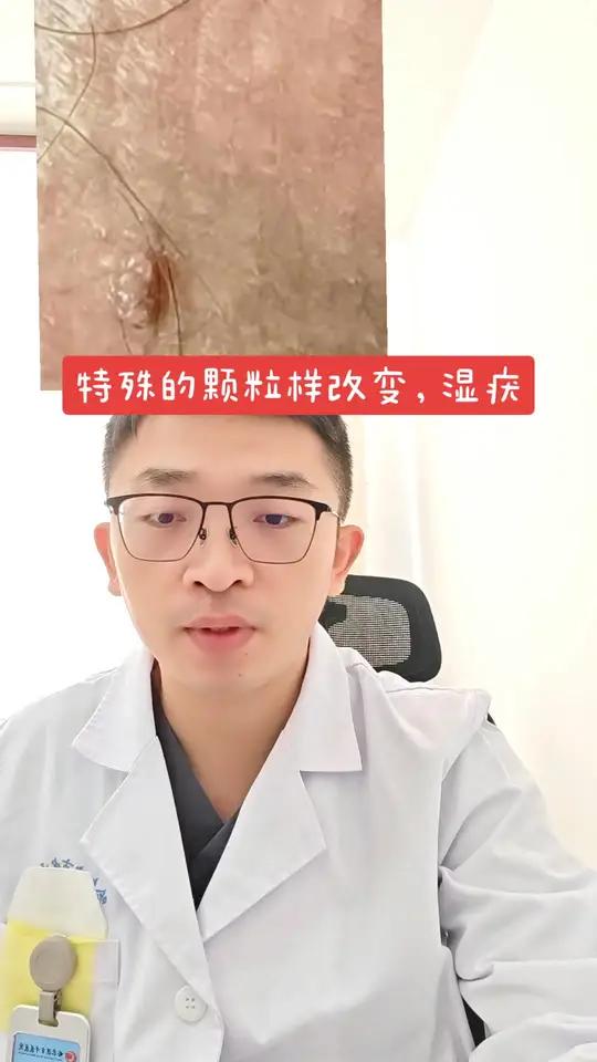 特殊的菜花样改变,湿疣