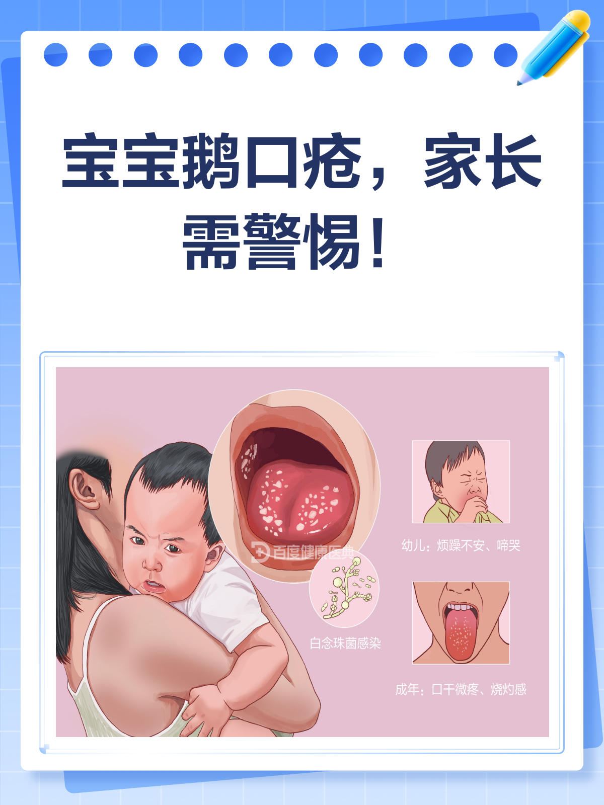 宝宝得了鹅口疮怎么办?别急,看这里!