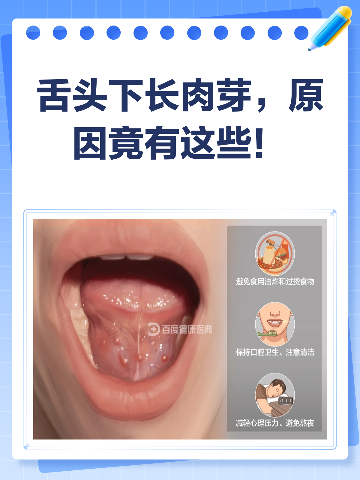 舌头下长小肉芽？别慌，先来看看这个！