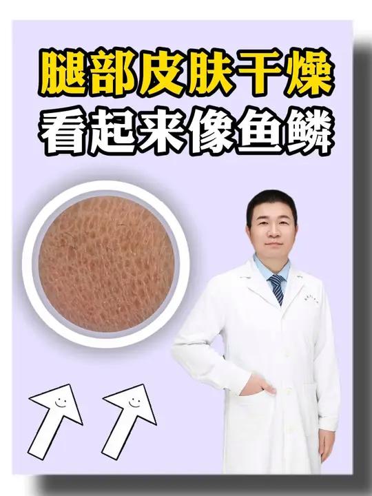 腿部皮肤干燥看起来像鱼鳞,怎么处理 鱼鳞病 干燥脱皮 硬核健康科普行动