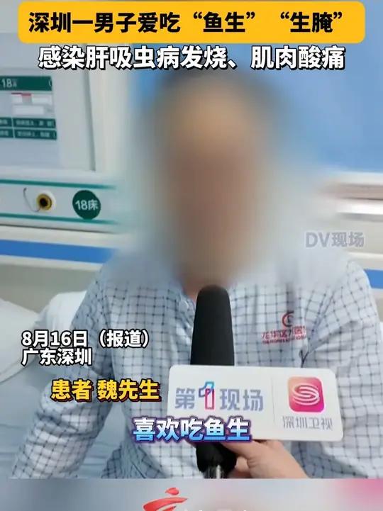 深圳一男子爱吃“鱼生”“生腌”,感染肝吸虫病发烧、肌肉酸痛