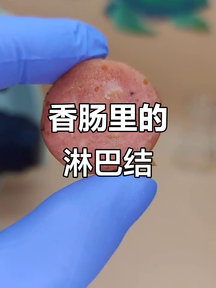 香肠里隐藏的淋巴肉,你吃过吗?