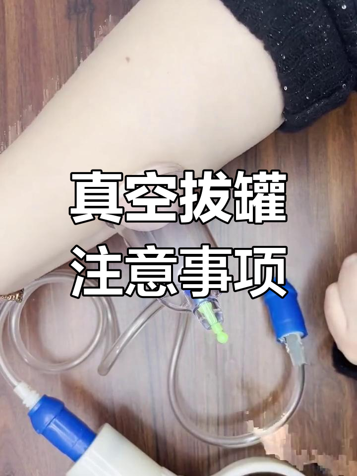 真空拔罐使用技巧:如何正确操作避免失误