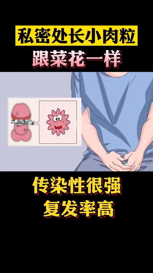 私密处长了菜花状的小肉粒,摸起来柔软,呈粉红色,这是xing病的一种!不洁x行为一定要避免