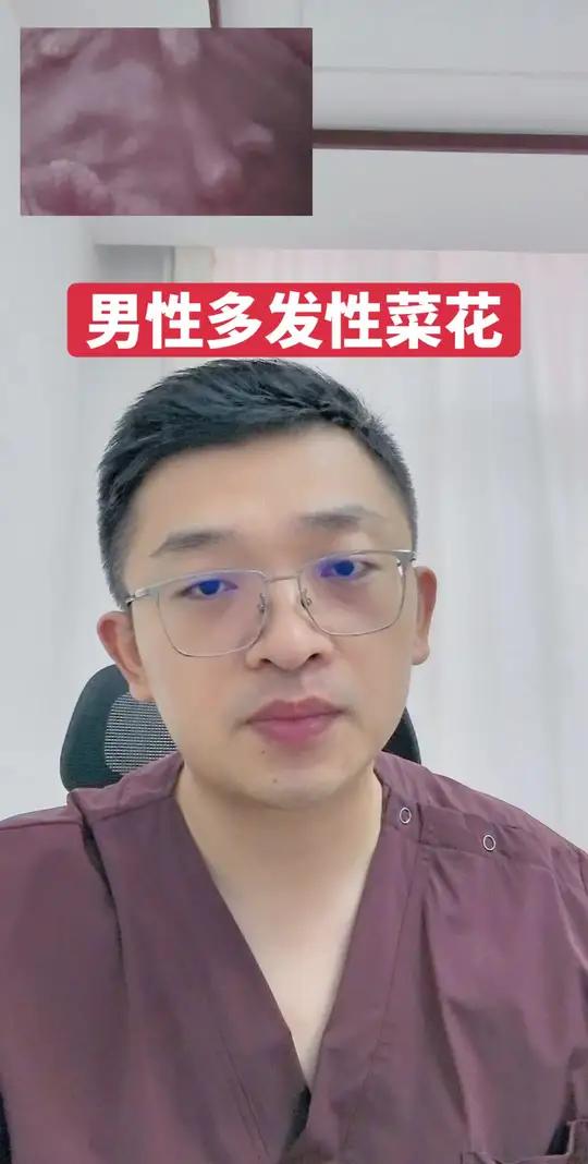 男性多发性菜花 