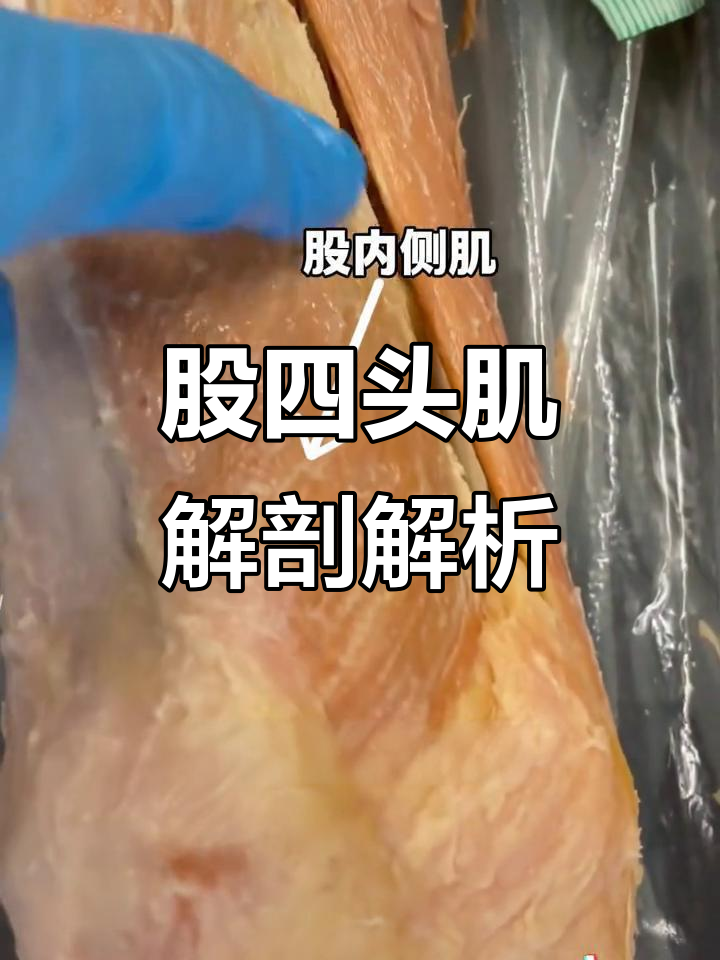 揭秘股四头肌:从骨质到中间肌,全解大腿肌肉结构