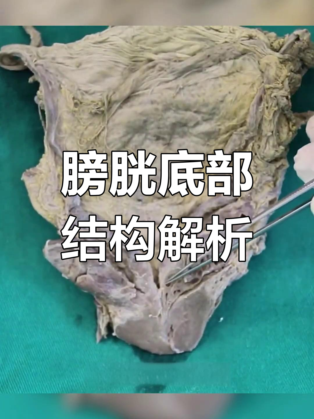 膀胱解剖与精囊腺功能