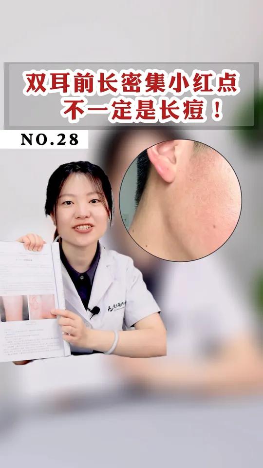 脸上也会长 鸡皮肤