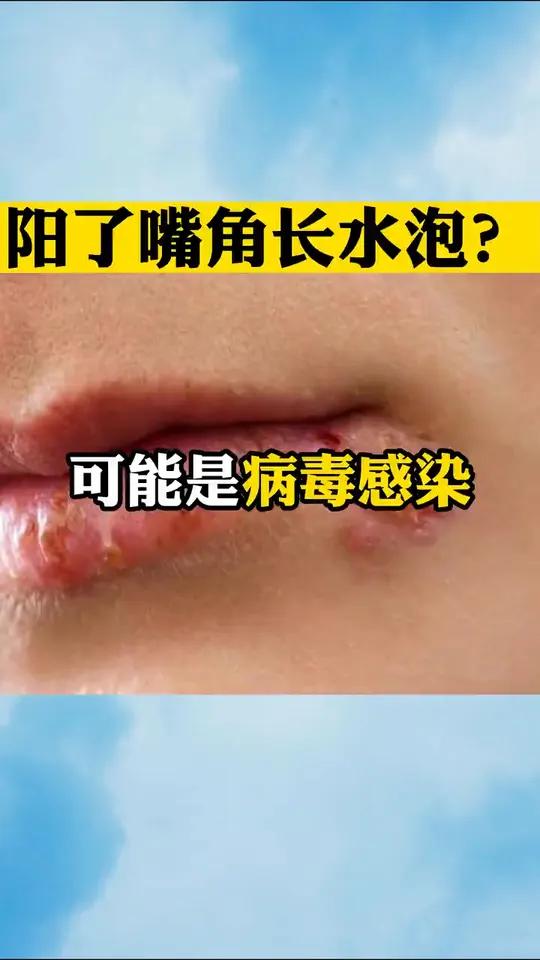 以后,嘴角长了米粒大小的小水泡,又疼又痒,这是病毒感染引起的