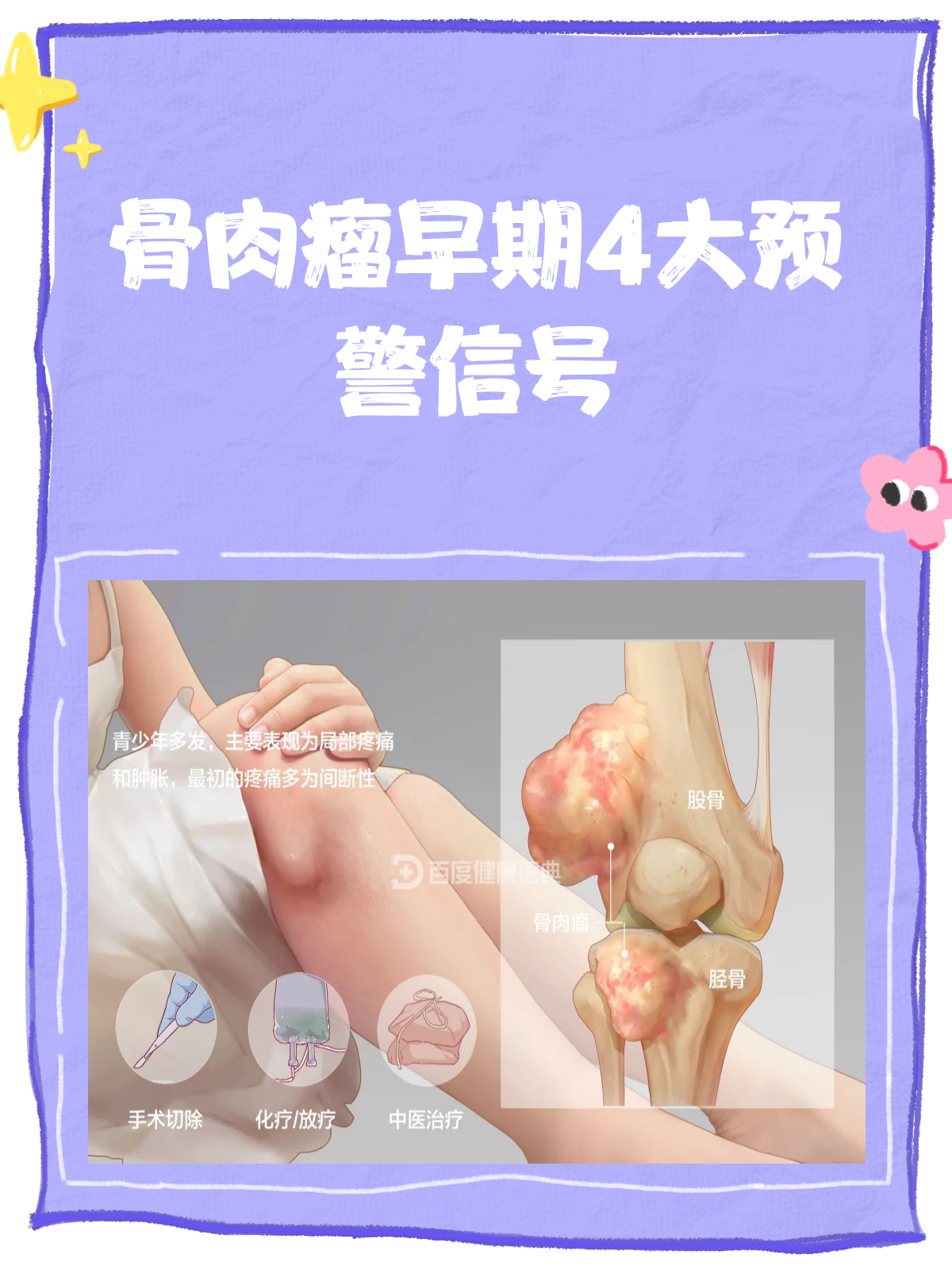 骨肉瘤早期,这些信号你收到了吗?