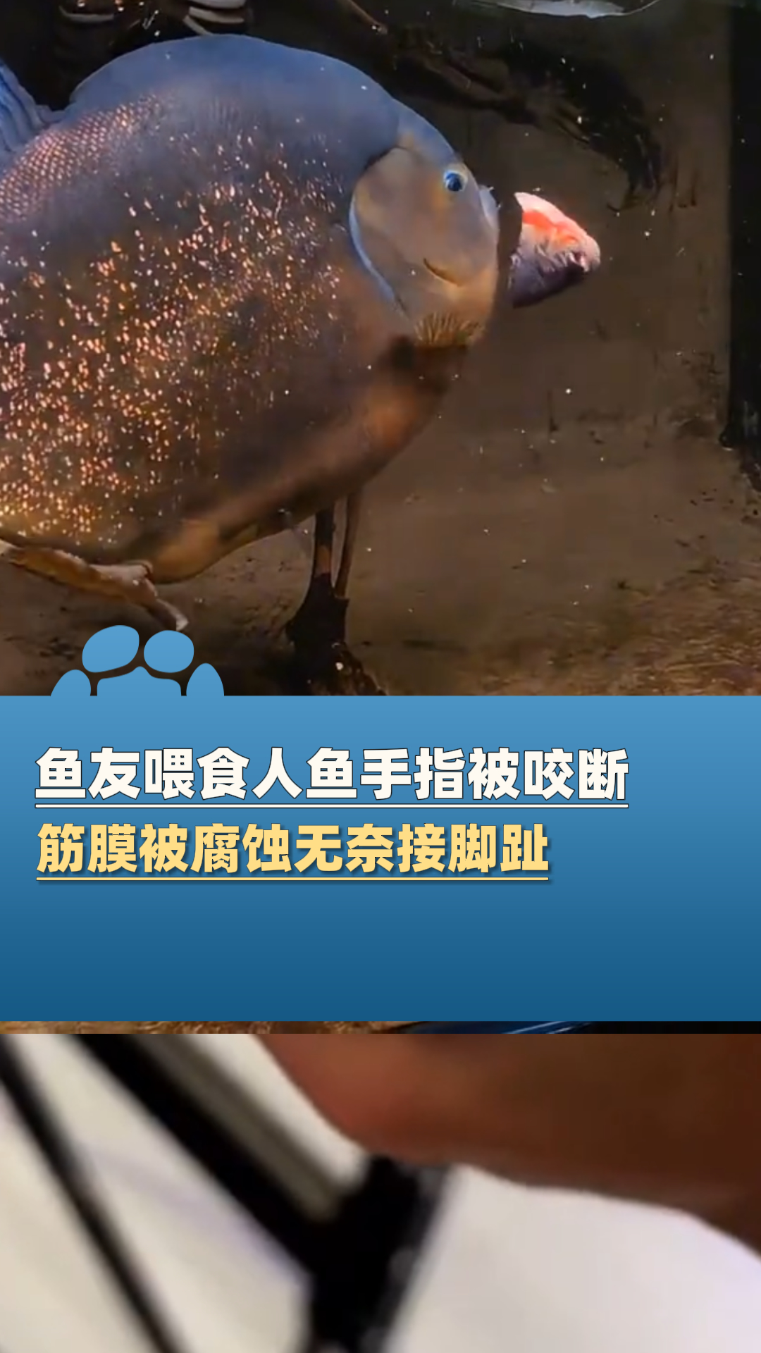 鱼友总喜欢用手拿肉喂食人鱼,手指被咬断!