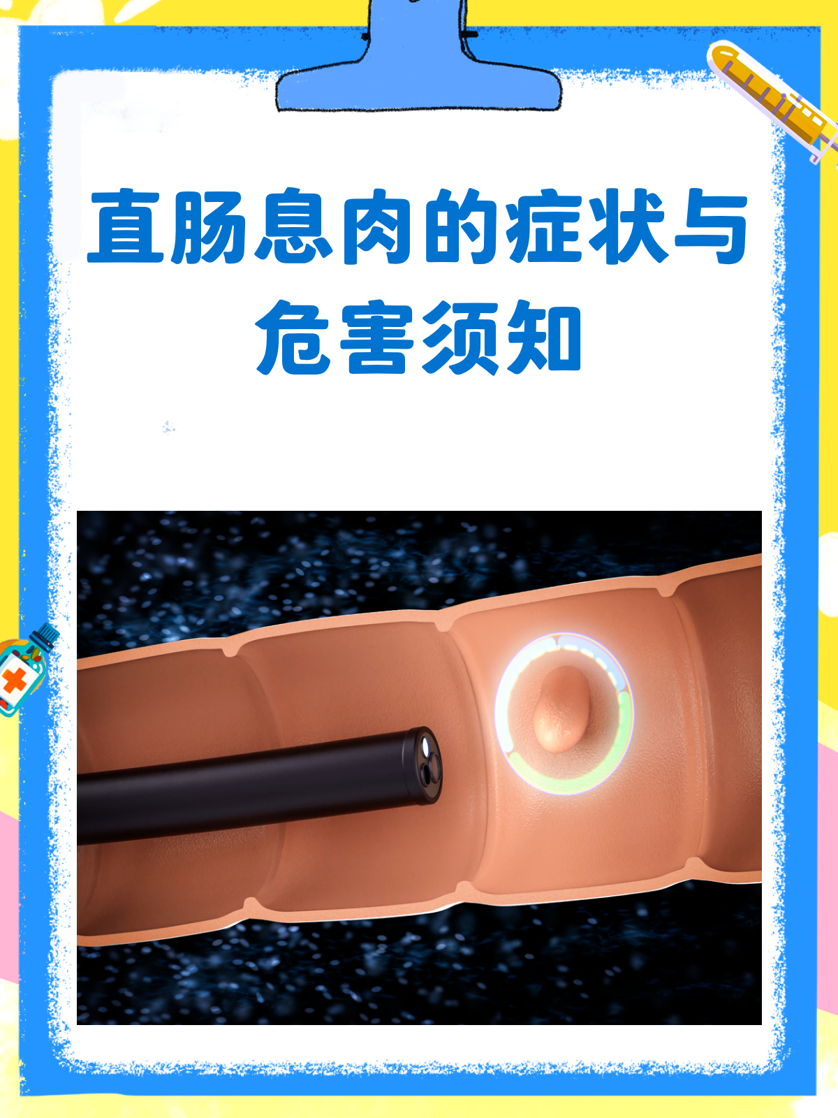 直肠息肉悄无声息?这些症状和危害你得知道!