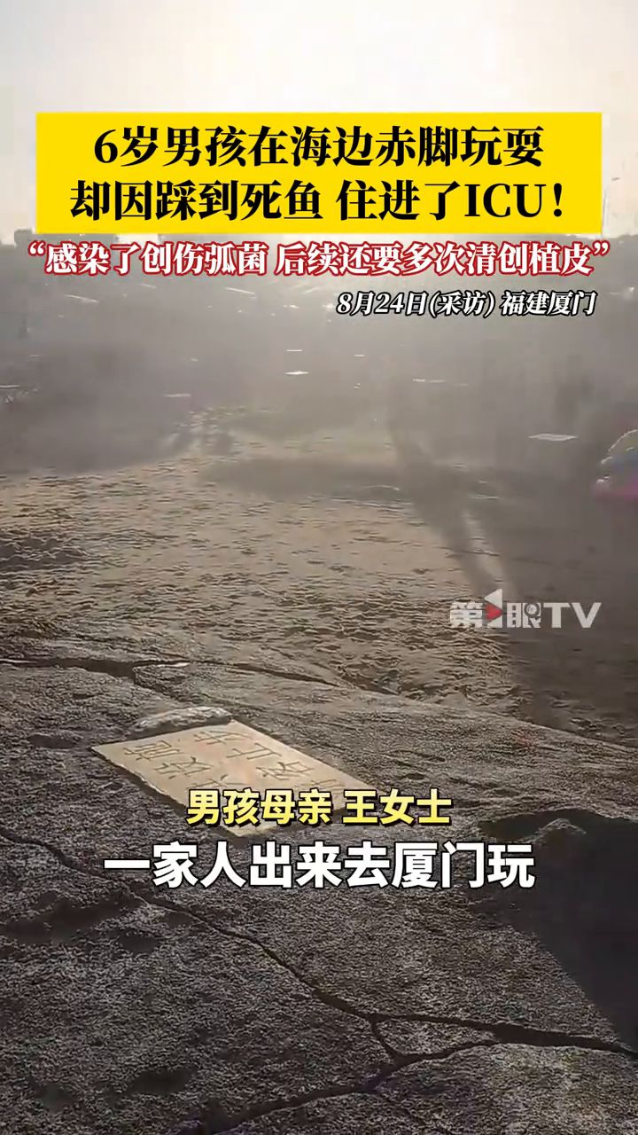 6岁男孩在海边赤脚玩耍,因踩到死鱼,直接住进了ICU!