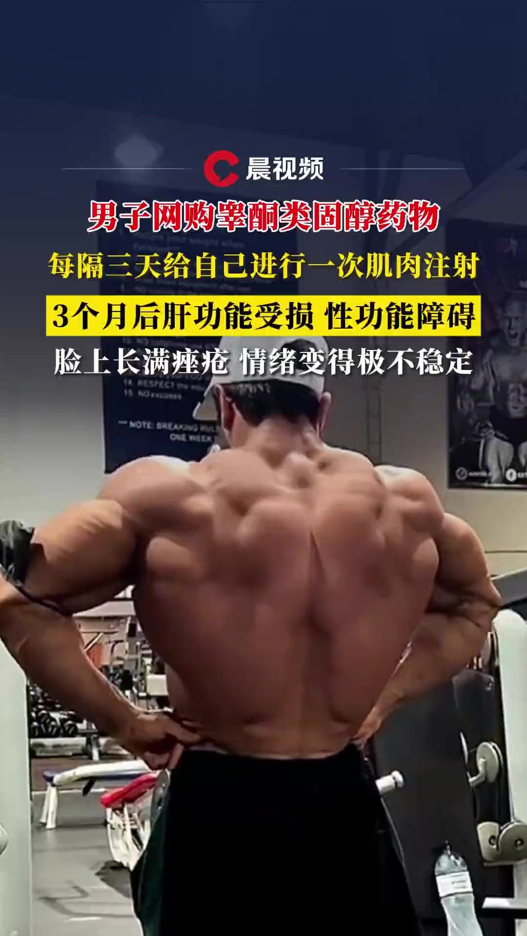 男子网购睾酮类固醇药物,每隔三天给自己进行一次肌肉注射,3个月后性功能障碍